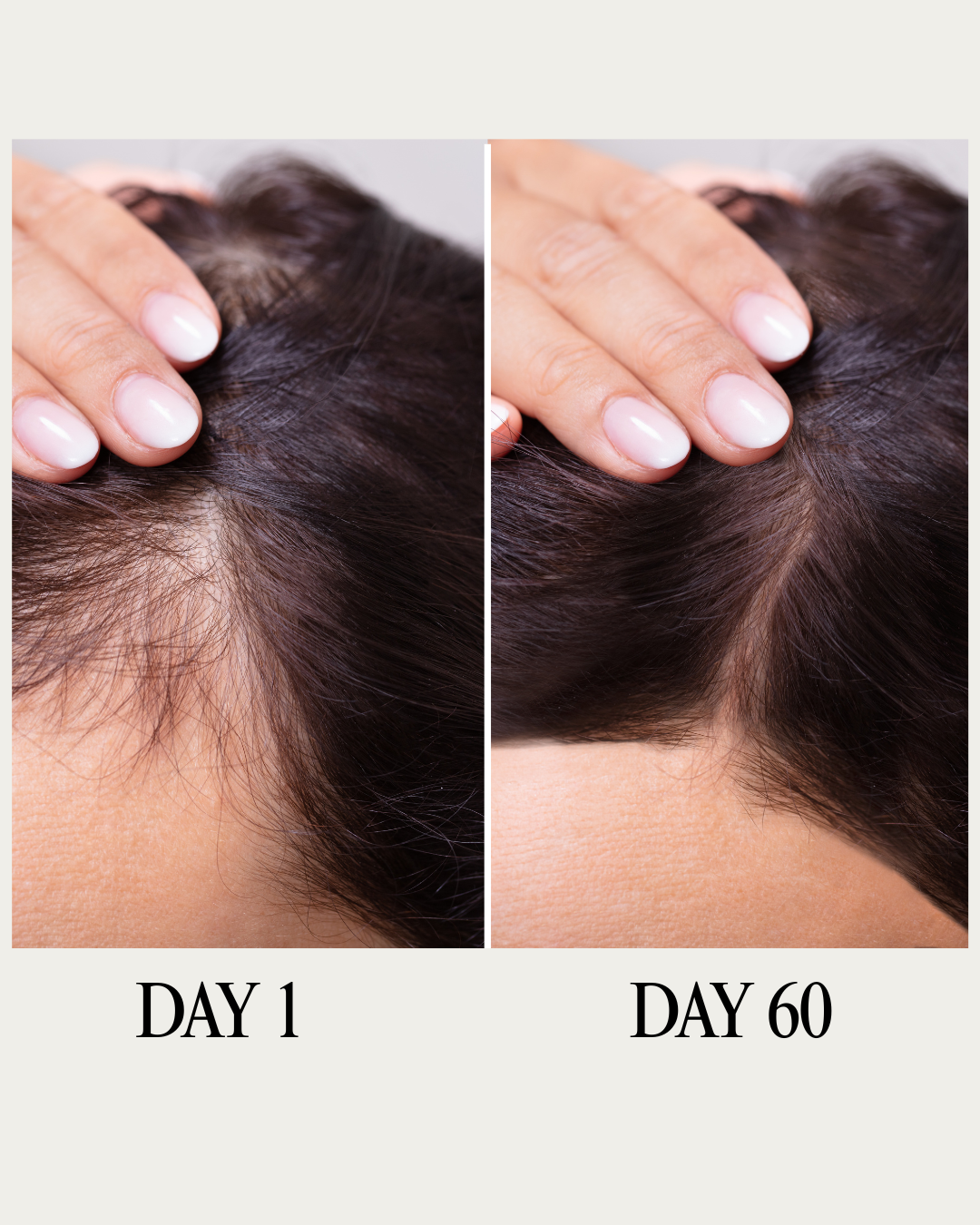 Indian Goddess Hair Growth and Treatment Oil