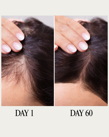 Indian Goddess Hair Growth and Treatment Oil